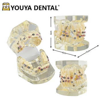Ortodôntico Modelo Ortho Suporte de Metal Modelo Para Clínicas Odontológicas Técnico de Estudante Dentista Médico-paciente Ferramenta de Comunicação